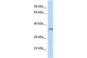 WB Suggested Anti-RGD1310788 Antibody Titration: 1. (HVCN1 Antikörper  (C-Term))