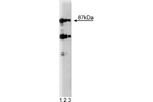 Western Blotting (WB) image for anti-Dystrobrevin (AA 249-403) antibody (ABIN968166) (Dystrobrevin (AA 249-403) Antikörper)