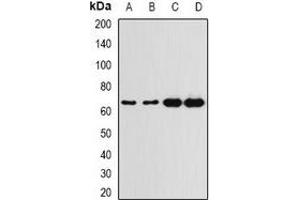 Western blot analysis of G6PD expression in A549 (A), HT29 (B), K562 (C), mouse spleen (D) whole cell lysates. (Glucose-6-Phosphate Dehydrogenase Antikörper)