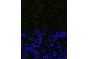 Immunofluorescence analysis of Raw264 7 cells using iNOS Rabbit mAb (ABIN1678965, ABIN3018084, ABIN3018085 and ABIN7101575) at dilution of 1:100 (40x lens). (NOS2 Antikörper)