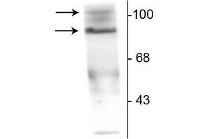 Western blot of T47D cell lysate prepared from cells that had been incubated in the presence of the synthetic progestin agonist R5020 (500 nM) showing specific immunolabeling of the ~90 kDa PR-A isoform and the ~120 kDa PR-B isoform of the progesterone receptor phosphorylated at Ser190. (Progesterone Receptor Antikörper  (pSer190))