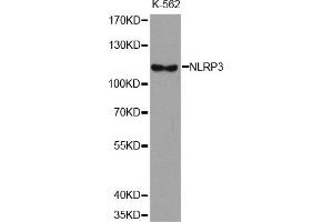 Western Blotting (WB) image for anti-NLR Family, Pyrin Domain Containing 3 (NLRP3) antibody (ABIN1876853) (NLRP3 Antikörper)