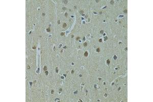 Immunohistochemistry of paraffin-embedded rat brain using UBE2I antibody. (UBE2I Antikörper)