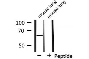 Western blot analysis of extracts from mouse lung , using ADCK5 Antibody. (ADCK5 Antikörper  (N-Term))