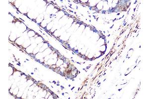 Immunohistochemistry of paraffin-embedded human colon using FHL1 Rabbit mAb (ABIN1680536, ABIN3019332, ABIN3019333 and ABIN7101753) at dilution of 1:100 (40x lens). (FHL1 Antikörper)