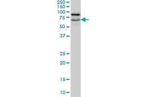 Western Blotting (WB) image for anti-Nucleolar and Coiled-Body Phosphoprotein 1 (NOLC1) (AA 590-700) antibody (ABIN598599) (NOLC1 Antikörper  (AA 590-700))