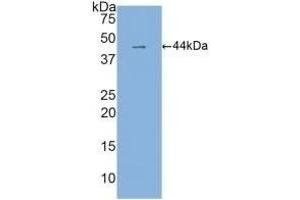 Detection of Recombinant IL6, Human using Monoclonal Antibody to Interleukin 6 (IL6) (IL-6 Antikörper  (AA 30-212))