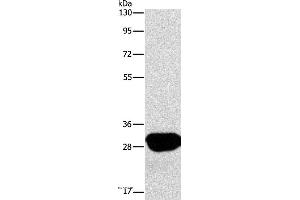 Western blot analysis of A549 cell, using LXN Polyclonal Antibody at dilution of 1:667 (Latexin Antikörper)