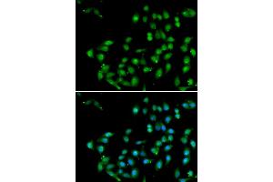 Immunofluorescence analysis of U20S cell using CTNNBL1 antibody. (CTNNBL1 Antikörper)