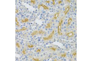 Immunohistochemistry of paraffin-embedded rat kidney using UBE2B Antibody. (UBE2B Antikörper)