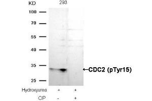 Western blot analysis of extracts from 293 cells, treated with Hydroxyurea or calf intestinal phosphatase (CIP), using CDC2 (Phospho-Tyr15) Antibody. (CDK1 Antikörper  (pTyr15))