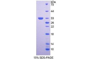 SDS-PAGE (SDS) image for Survival of Motor Neuron 2, Centromeric (SMN2) (AA 16-251) protein (His tag) (ABIN4989840) (SMN2 Protein (AA 16-251) (His tag))