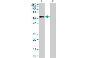 Western Blot analysis of GSR expression in transfected 293T cell line by GSR MaxPab polyclonal antibody. (Glutathione Reductase Antikörper  (AA 1-522))
