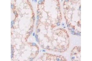 IHC-P analysis of Kidney tissue, with DAB staining. (HSD17B12 Antikörper  (AA 1-312))