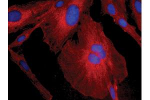 Human astrocytoma cell line CCF-STTG1 was stained with Mouse Anti-Human GFAP-CY3 and DAPI. (GFAP Antikörper  (HRP))