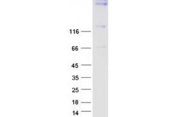 Synaptojanin 1 Protein (SYNJ1) (Transcript Variant 2) (Myc-DYKDDDDK Tag)