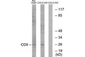 Western Blotting (WB) image for anti-CD9 (CD9) (AA 101-150) antibody (ABIN2889898) (CD9 Antikörper  (AA 101-150))