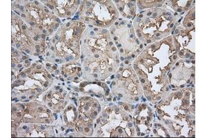Immunohistochemical staining of paraffin-embedded Human prostate tissue using anti-BSG mouse monoclonal antibody. (CD147 Antikörper)