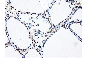 Immunohistochemical staining of paraffin-embedded liver tissue using anti-HDAC10mouse monoclonal antibody. (HDAC10 Antikörper)