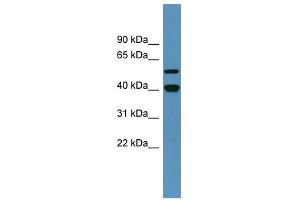 Western Blot showing DDB2 antibody used at a concentration of 1-2 ug/ml to detect its target protein. (DDB2 Antikörper  (C-Term))