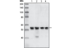 Western blot analysis using CHK1 antibody against HEK293T cells transfected with the pCMV6-ENTRY control (1) and pCMV6-ENTRY CHK1 cDNA (2). (CHEK1 Antikörper)