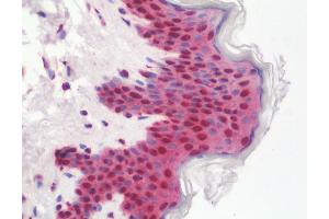 Anti-ETV6 / TEL antibody IHC staining of human skin. (ETV6 Antikörper  (AA 84-111))