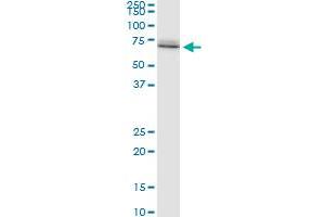 HSPA1A polyclonal antibody (A01), Lot # 070831JCSe. (HSP70 1A Antikörper  (AA 1-641))