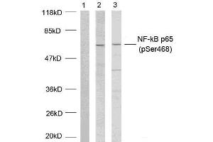Western blot analysis of extracts using NF-κB p65 (phospho-Ser468) antibody (E011013). (NF-kB p65 Antikörper  (pSer468))