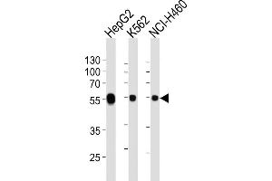Lane 1: HepG2 Cell lysates, Lane 2: K562 Cell lysates, Lane 3: NCI-H460 Cell lysates, probed with ALDH1A1 (152CT1. (ALDH1A1 Antikörper)