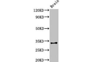 Western Blot Positive WB detected in: Mouse brain tissue All lanes: Cd74 antibody at 3 μg/mL Secondary Goat polyclonal to rabbit IgG at 1/50000 dilution Predicted band size: 32, 25 kDa Observed band size: 32 kDa (CD74 Antikörper  (AA 56-279))