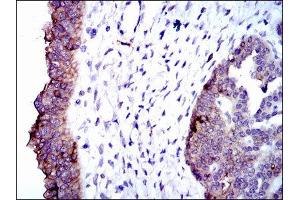 Immunohistochemistry (IHC) image for anti-Alkaline Phosphatase, Liver/bone/kidney (ALPL) antibody (ABIN1845845) (ALPL Antikörper)