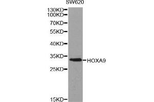 Western Blotting (WB) image for anti-Homeobox A9 (HOXA9) antibody (ABIN1873074) (HOXA9 Antikörper)