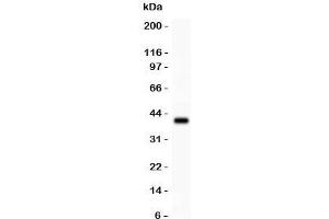 Western blot testing of TdT antibody and recombinant human protein (0. (TdT Antikörper  (AA 316-509))