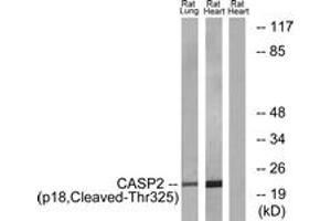 Western Blotting (WB) image for anti-Caspase 2, Apoptosis-Related Cysteine Peptidase (CASP2) (AA 276-325), (Cleaved-Thr325) antibody (ABIN2891171) (Caspase 2 Antikörper  (Cleaved-Thr325))