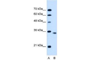 ACVR2B antibody used at 0. (ACVR2B Antikörper  (C-Term))