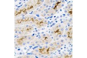 Immunohistochemical analysis of SET staining in mouse kidney formalin fixed paraffin embedded tissue section. (SET/TAF-I Antikörper)