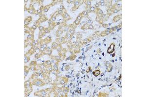 Immunohistochemistry of paraffin-embedded human liver using CSH1 antibody. (CSH1 Antikörper)