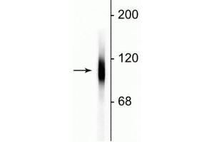 Western blot of HeLa cell lysate showing specific immunolabeling of the ~100 kDa LAMP1 protein. (LAMP1 Antikörper)