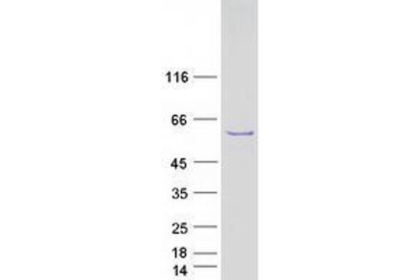 TBL1Y Protein (Transcript Variant 1) (Myc-DYKDDDDK Tag)