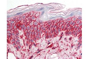 Anti-CD44 antibody IHC staining of human skin. (CD44 Antikörper)