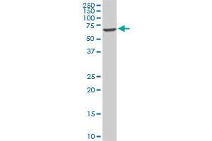 Western Blotting (WB) image for anti-EPM2A (Laforin) Interacting Protein 1 (EPM2AIP1) (AA 508-606) antibody (ABIN564241)