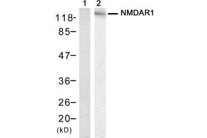 Western blot analysis of extract from mouse brain tissue, using NMDAR1 (Ab-896) Antibody (E021133, Lane 1 and 2). (GRIN1/NMDAR1 Antikörper)