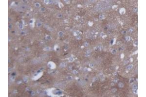 DAB staining on IHC-P; Samples: Mouse Cerebrum Tissue (SYN2 Antikörper  (AA 88-422))