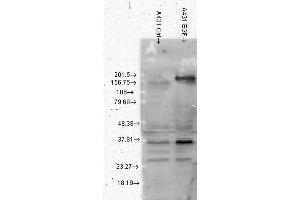 Western Blot analysis of Human A431 cell lysates showing detection of Phosphotyrosine protein using Mouse Anti-Phosphotyrosine Monoclonal Antibody, Clone G104 . (Phosphotyrosine Antikörper  (Atto 390))