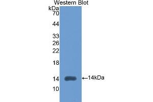 Western Blotting (WB) image for anti-Lysyl Oxidase-Like 2 (LOXL2) (AA 434-546) antibody (ABIN1176466) (LOXL2 Antikörper  (AA 434-546))