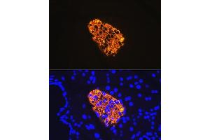 Immunofluorescence analysis of rat pancreas using Insulin Rabbit mAb (ABIN7267886) at dilution of 1:100 (40x lens). (Insulin Antikörper)