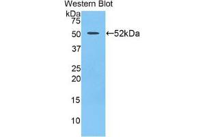 Western blot analysis of the recombinant protein. (Uracil Phosphoribosyltransferase (UPP) (AA 75-297) Antikörper)