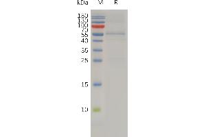 Human T Protein, hFc Tag on SDS-PAGE under reducing condition. (TIMP4 Protein (AA 30-224) (Fc Tag))
