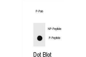 Dot blot analysis of Phospho-KIT- Antibody Phospho-specific Pab g on nitrocellulose membrane. (KIT Antikörper  (pThr718))