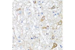 Immunohistochemistry of paraffin-embedded rat brain using SERPINA7 antibody. (SERPINA7 Antikörper)